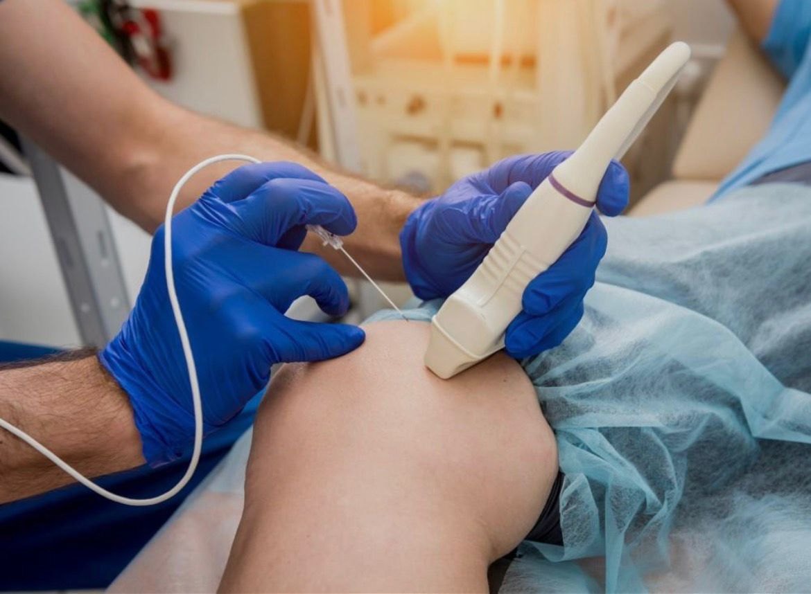 Ultrasound-guided knee injection at Nexus Medical